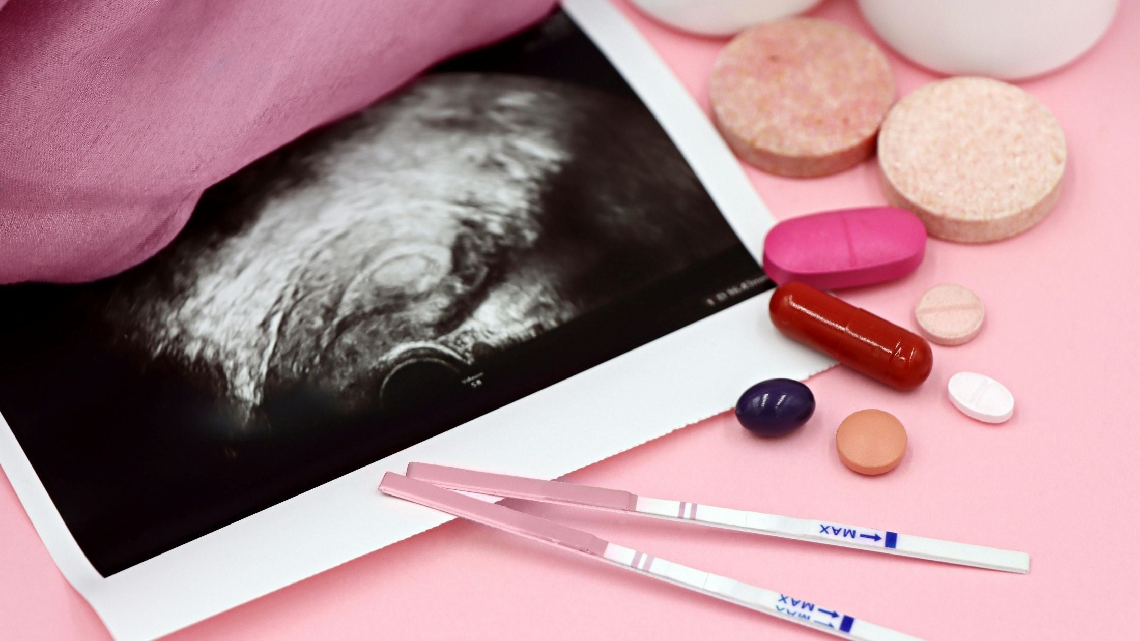 Come riconoscere i giorni fertili per aumentare le probabilità di concepimento