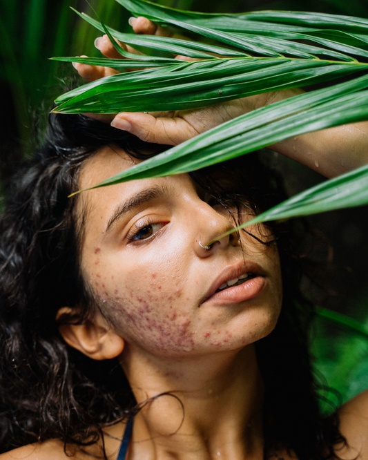 5 Nutrienti Che Migliorano Pelle e Benessere Intimo (Insieme!)