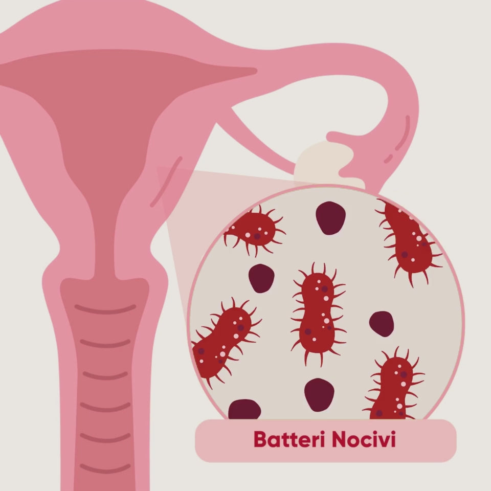 Carica il video: 